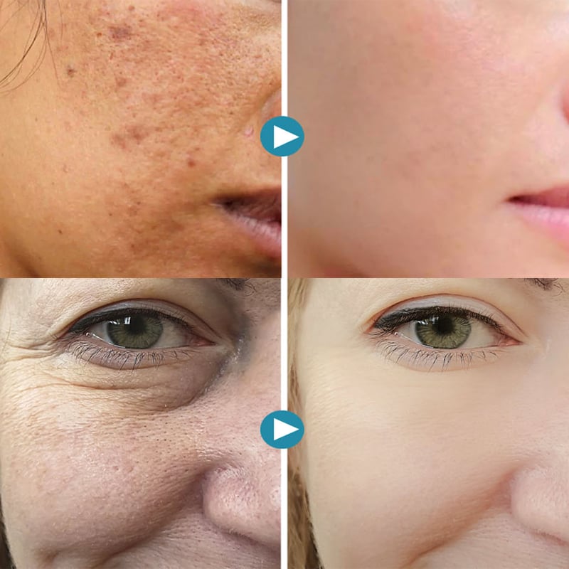 (💥BUY 1 GET 1 FREE⏰) 2024 New Magical Pore Eraser Waterproof Face  Primer Stick