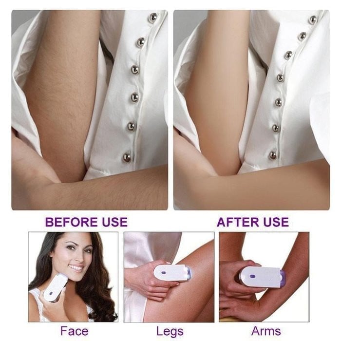 🔥🔥  Silky Smooth Hair Eraser（UK plug）