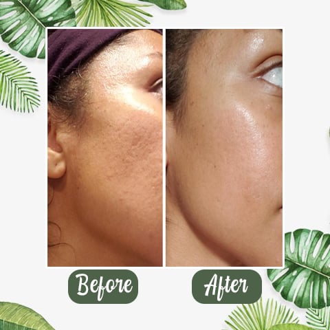 Last Day Promotion 49% OFF - 🔥Green Tea Deep Cleanse Mask